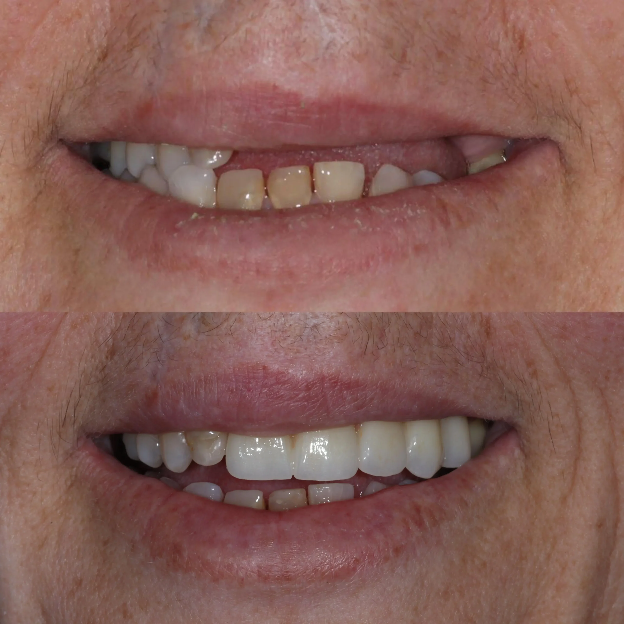 Imagem-do-WhatsApp-de-2025-08-22-à_s_-18.37.45_40f2a7b8 (1)