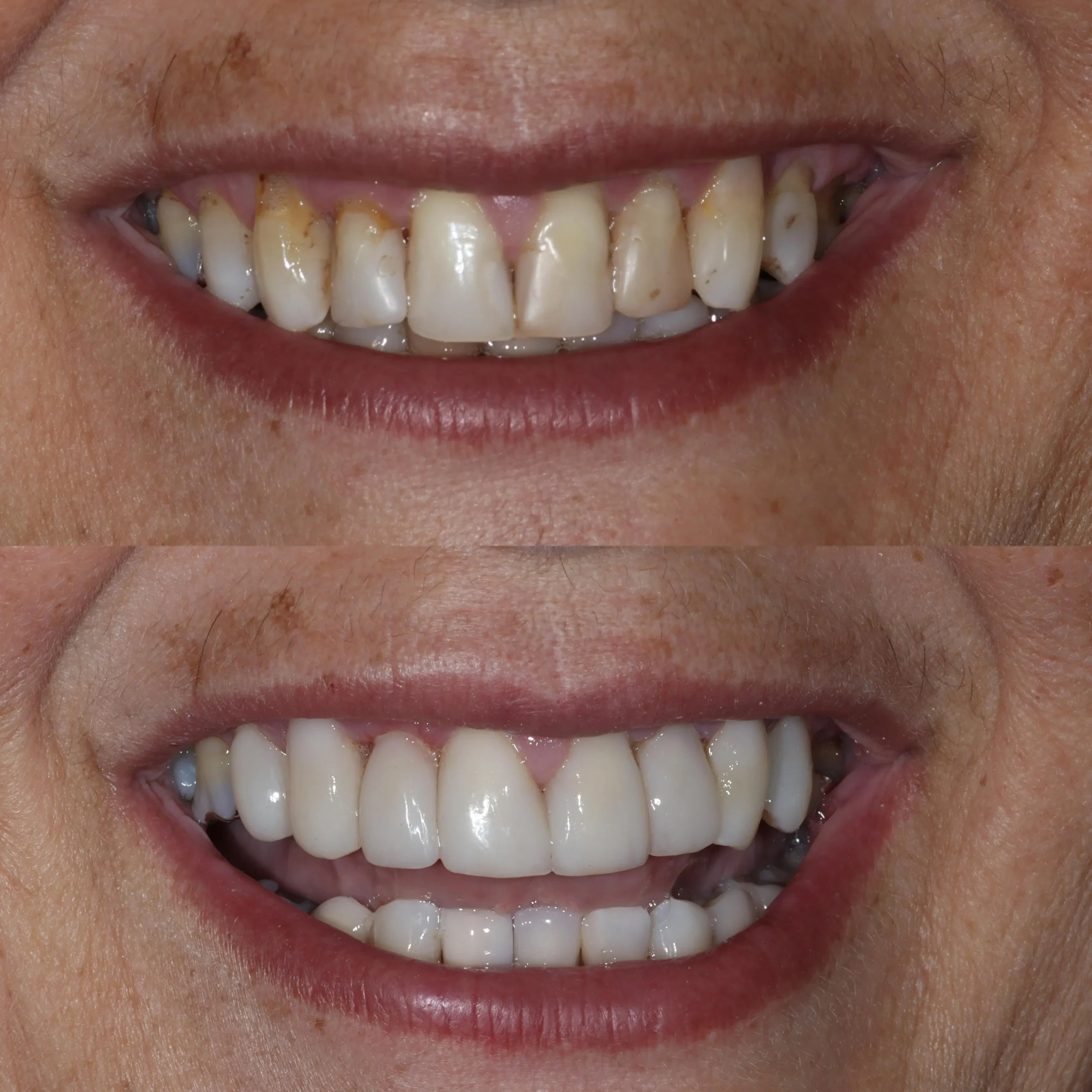 Imagem-do-WhatsApp-de-2025-08-22-à_s_-18.37.45_b76721e9