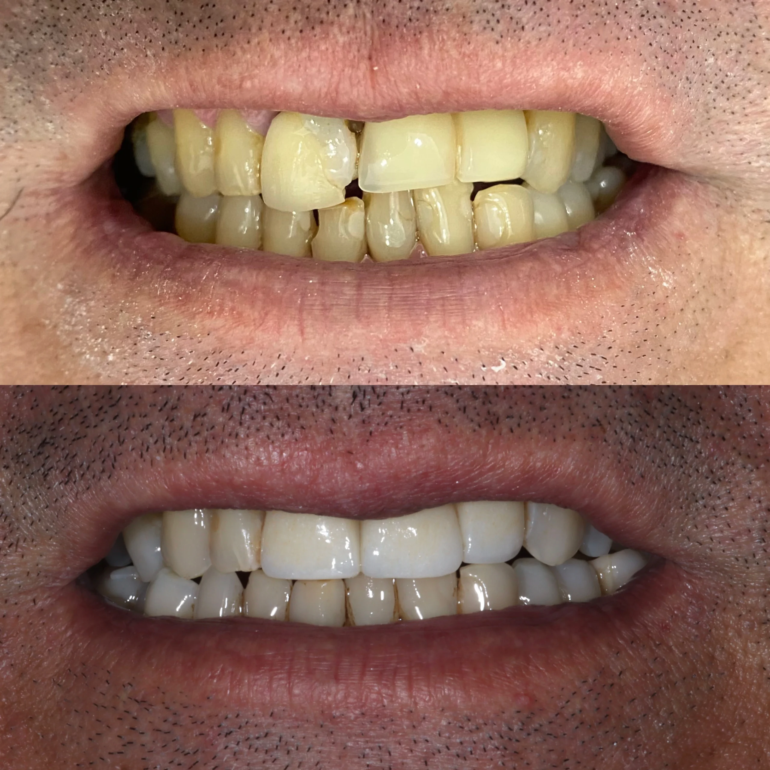 Rot 3 antes e depois